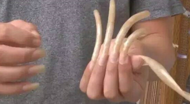 男子指甲留9年13厘米 为何留这么长又怪异的指甲?