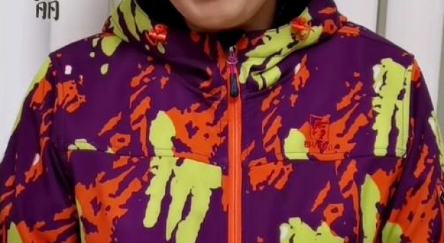 61岁丁嘉丽留狗啃刘海,眼底青黑嘴巴歪了,离婚两次养儿不养女