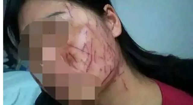 河南女子脸部被划百刀致毁容 竟是老公与小三下毒手