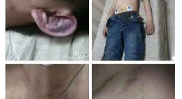 为筹母亲手术费当“肾贩子”揭黑幕：聊天群找肾源