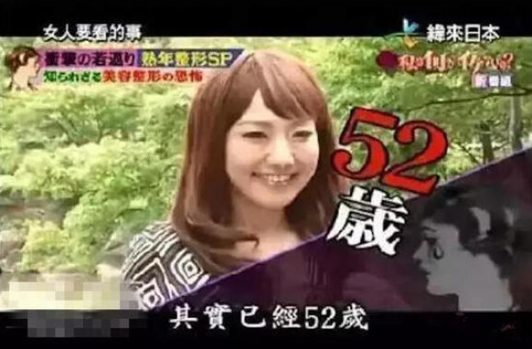 日52岁大妈为做小姐整成少女 3年动刀20次花450万日元