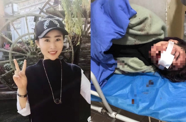 女子在丽江遭暴打抢劫 碎酒瓶划脸做伤情鉴定被拒绝
