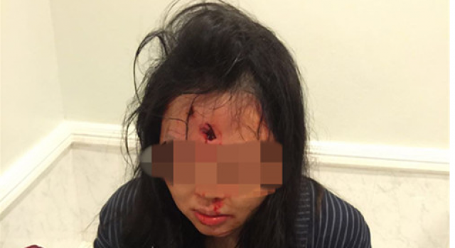 一家3口在南非遭遇枪击母女中枪 中大使馆介入调查
