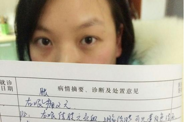 26岁女白领眼睛长满结石 因春节每天追剧至凌晨3点