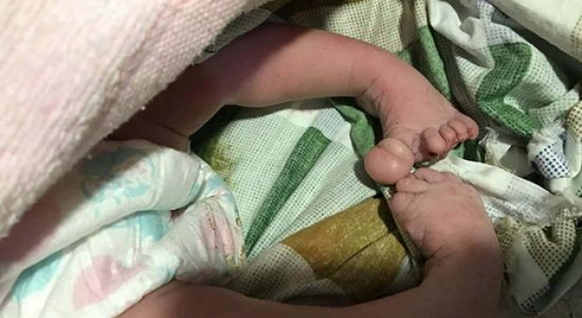 六次彩超均被告知发育正常 孕妇生下手足畸形儿
