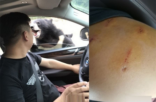 黑熊扒下车窗咬伤游客手臂 八达岭动物园又现动物伤人!