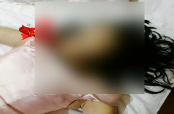17岁伴娘醉酒死在酒店 死亡原因疑似被劝酒