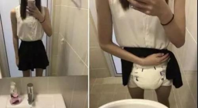 女生发掀裙自拍照惊呆众人 因为它从此离不开尿布