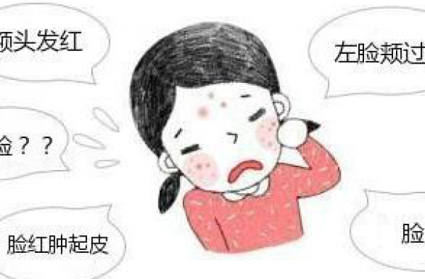 激素脸用什么治疗最好？激素脸用什么药最好