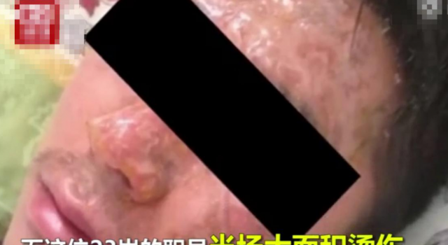 公司老板将员工的脸按进火锅 社长说这是在开玩笑？