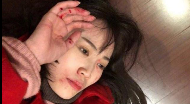 网曝马蓉被王宝强打进医院 究竟是摆拍还是真的？