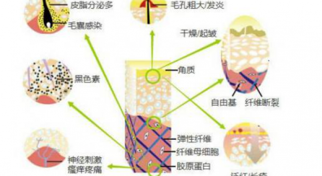 激素脸皮肤过敏怎么办 激素脸经常过敏怎么办
