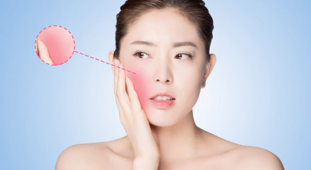 激素脸逆光疹子怎么办？激素脸逆光疹子多久能好