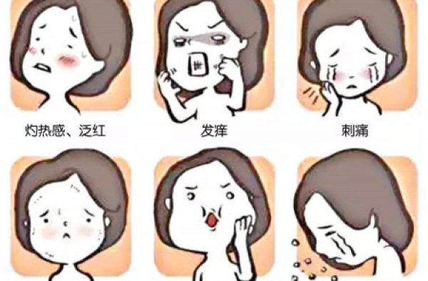 激素脸的表现有哪些？介绍激素脸正确的治疗方法