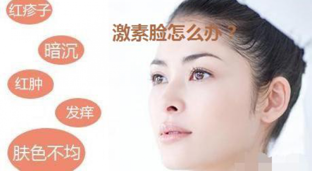 激素脸应该怎么治疗，激素脸多长时间能治愈