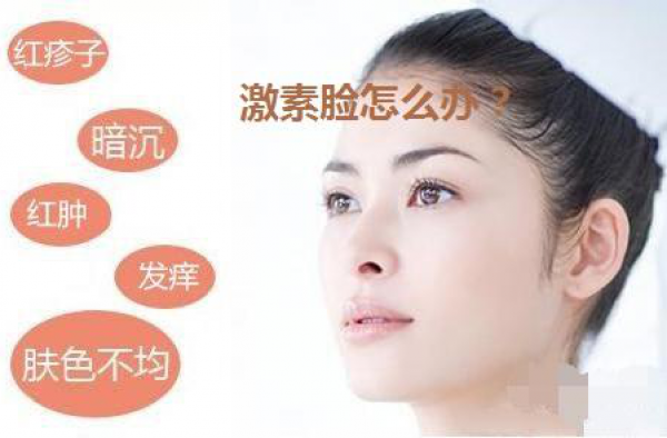 怎样才能调理激素脸？分享激素脸的治疗方法用什么好