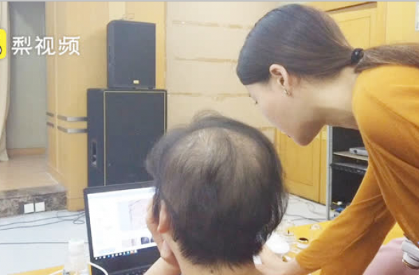 女白领发量剩3成 这叫秃如其来？为什么就3成了？