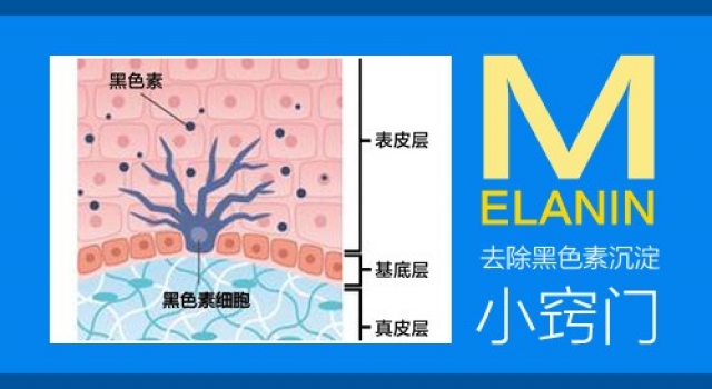 肌肤黑色素沉淀怎么去除？精心汇总去黑粉嫩好方法
