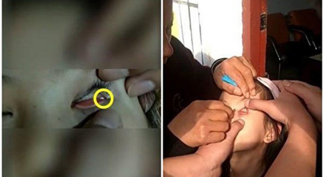 女孩被男同学往眼里强塞纸片 校长大事化小 网友：休想