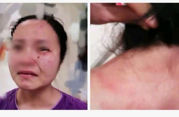 邓主任对广州护士被打事件压制 被全网唾骂惹争议