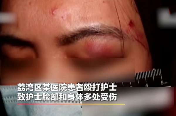 广州医院一男患者殴打女护士 因心情不好 网友：火化吧