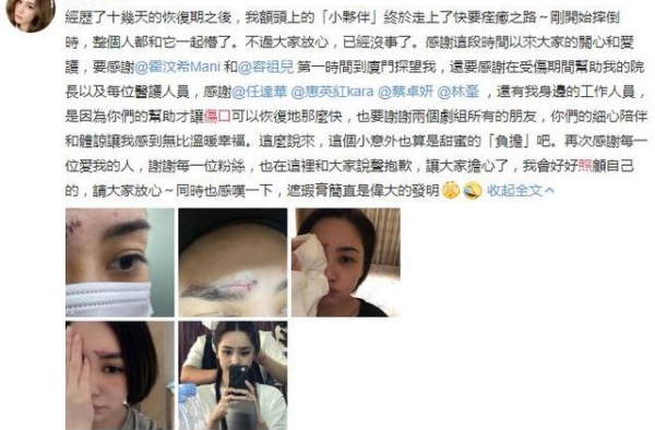 阿娇晒伤口，从眉骨伤到鼻梁处，缝数百针好吓人，不要留疤啊