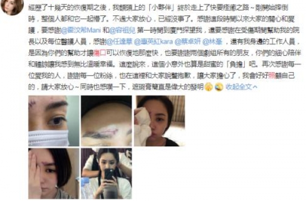 阿娇伤口照曝光是什么样的？额头密密麻麻的一条线看着有些吓人