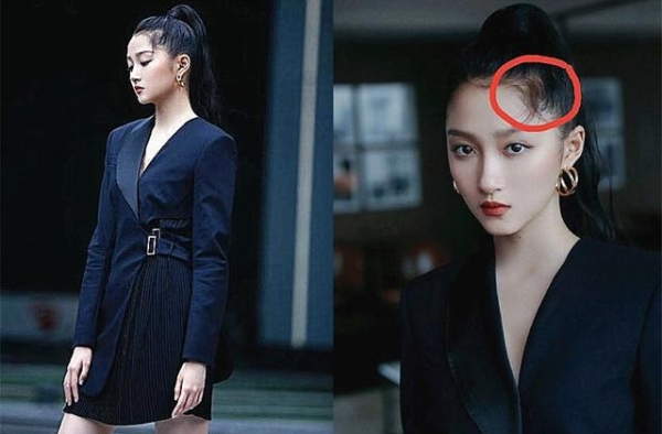明星发际线：关晓彤引热议，赵露思惹人羡，蔡徐坤郭麒麟有对策