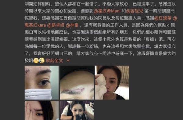 阿娇做客直播间，在线状态完全看不出受过伤？