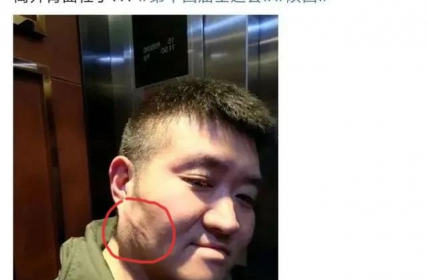 苗阜发微自爆被打后秒删，打人者张玉浩发微“因果有循环”